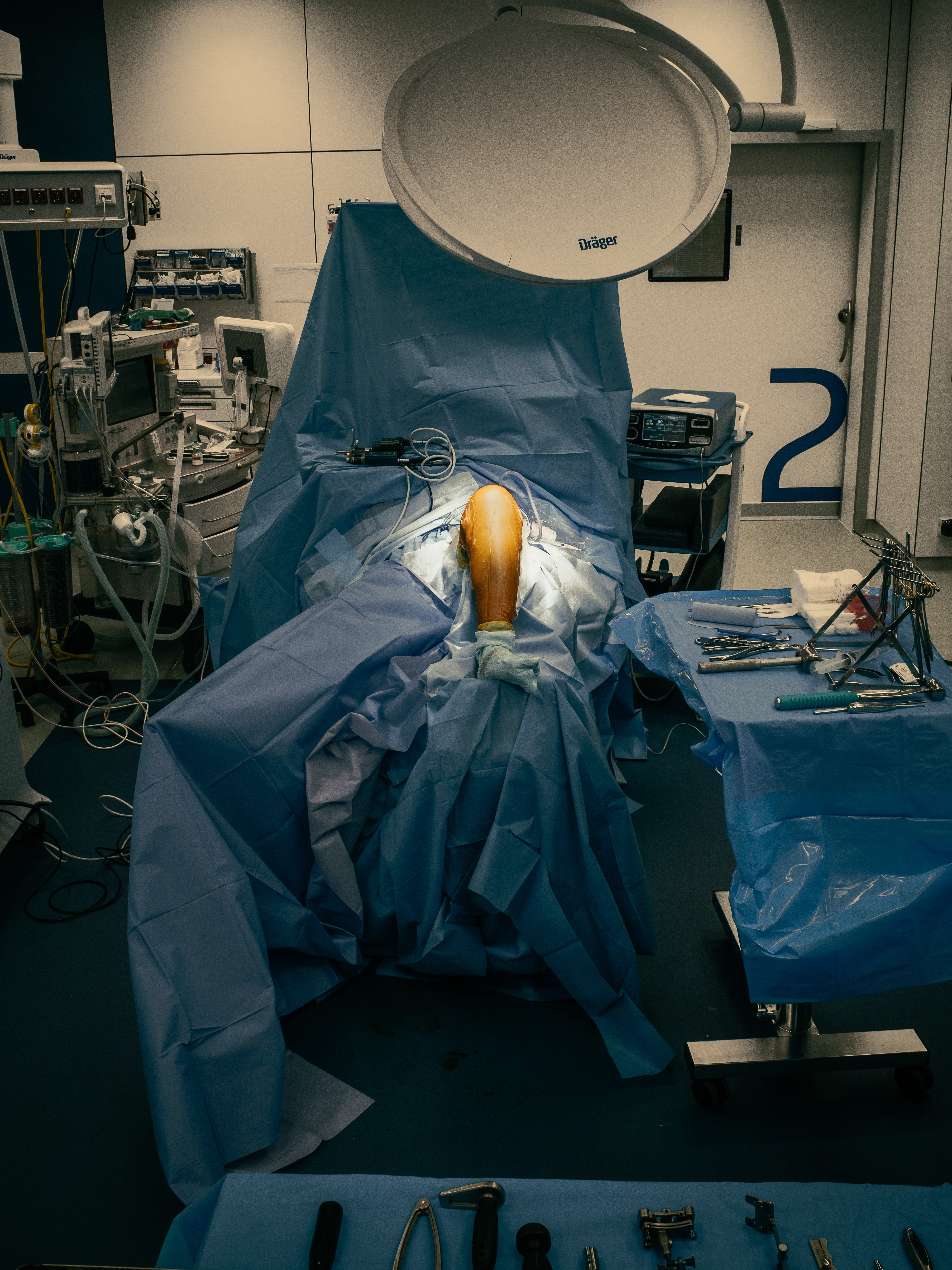 3 months in a surgery room.